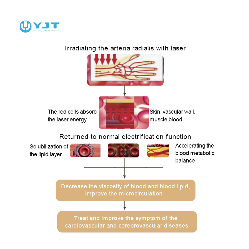 YJT OEM ODM Smart Watch Hot Sa - đánh giá và giá Smartwatch Watches For Sale